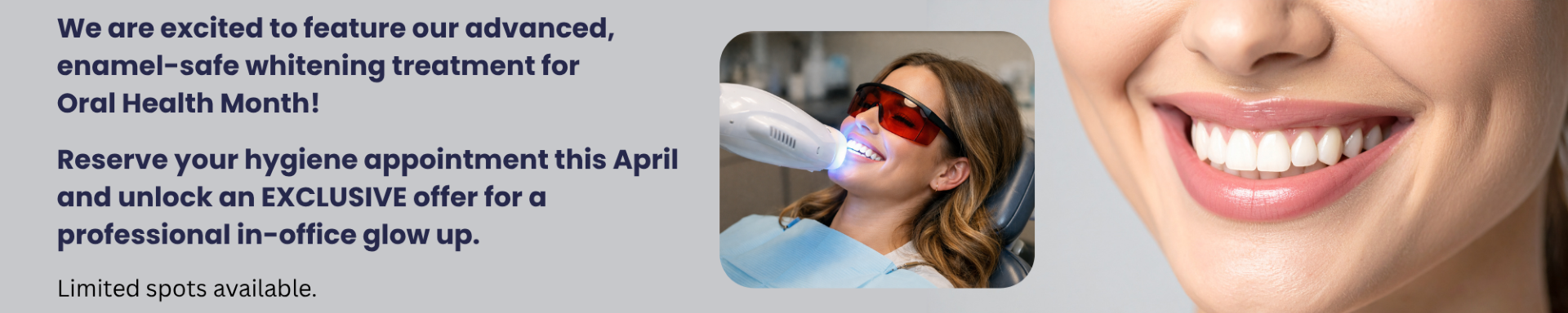 Advanced Enamel-Safe Whitening treatment for oral health month at Downtown Whitby Dentistry